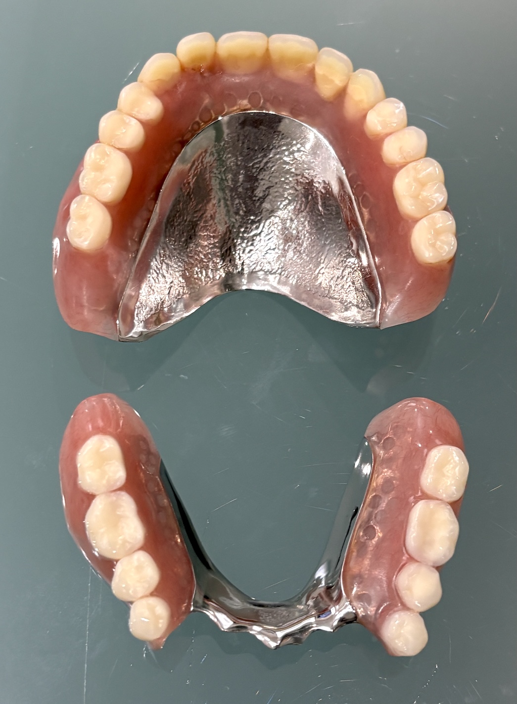 チタン床義歯
